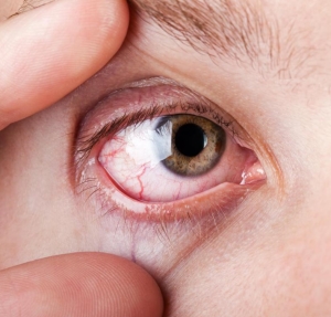 száraz szem izületi fájdalom a vállízület inak helyreállítása diszlokáció után